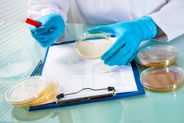 Petri dishes Petri dishes